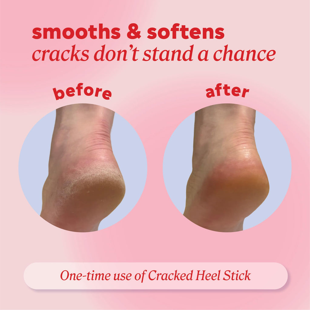 Onyx Professional cracked heel stick ingredients and net weight label