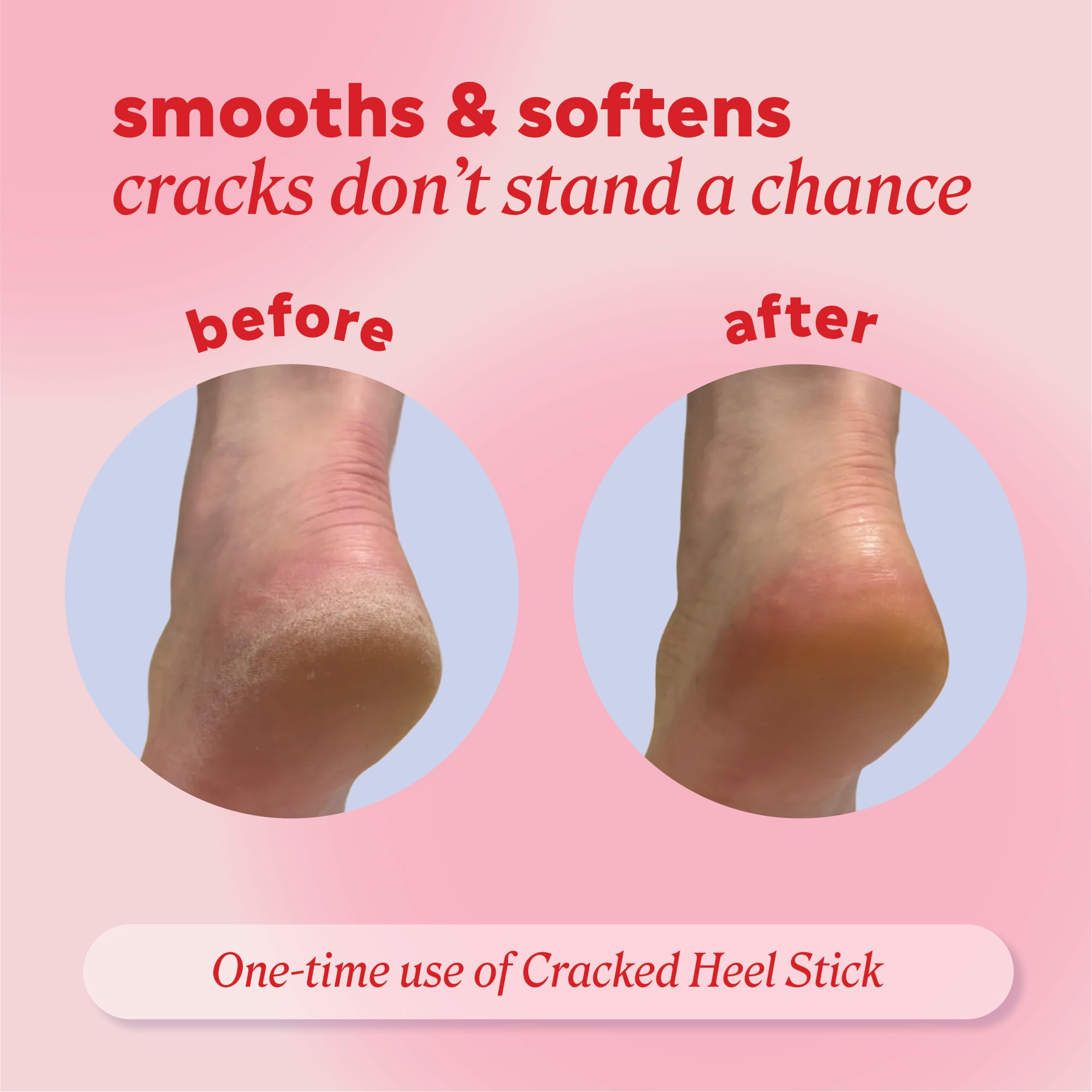 Onyx Professional moisturizing heel stick for dry feet remedy