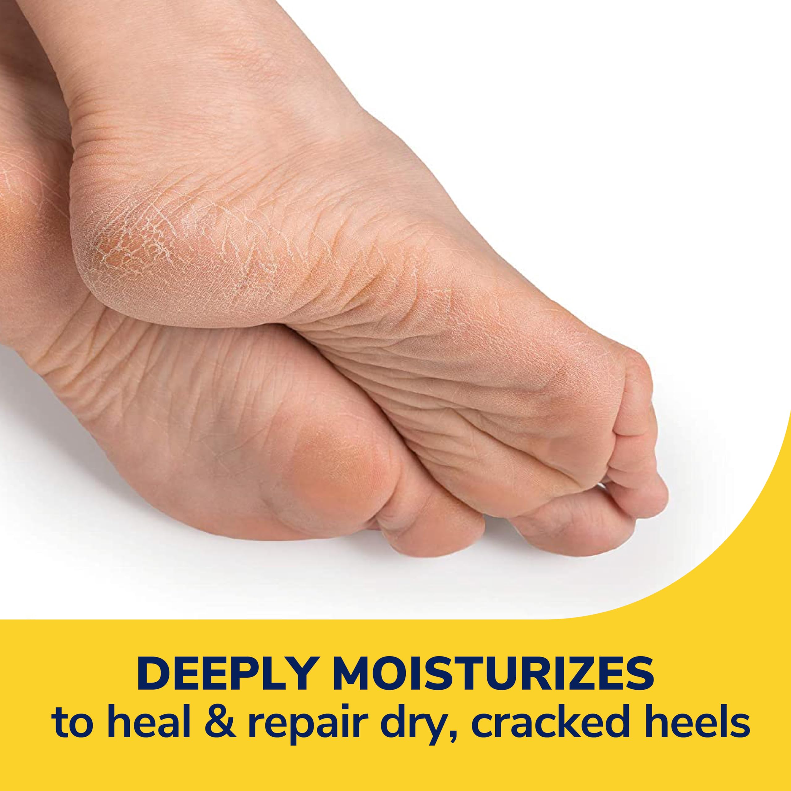 Dermatologist tested diabetic safe foot balm for severe heel cracks.