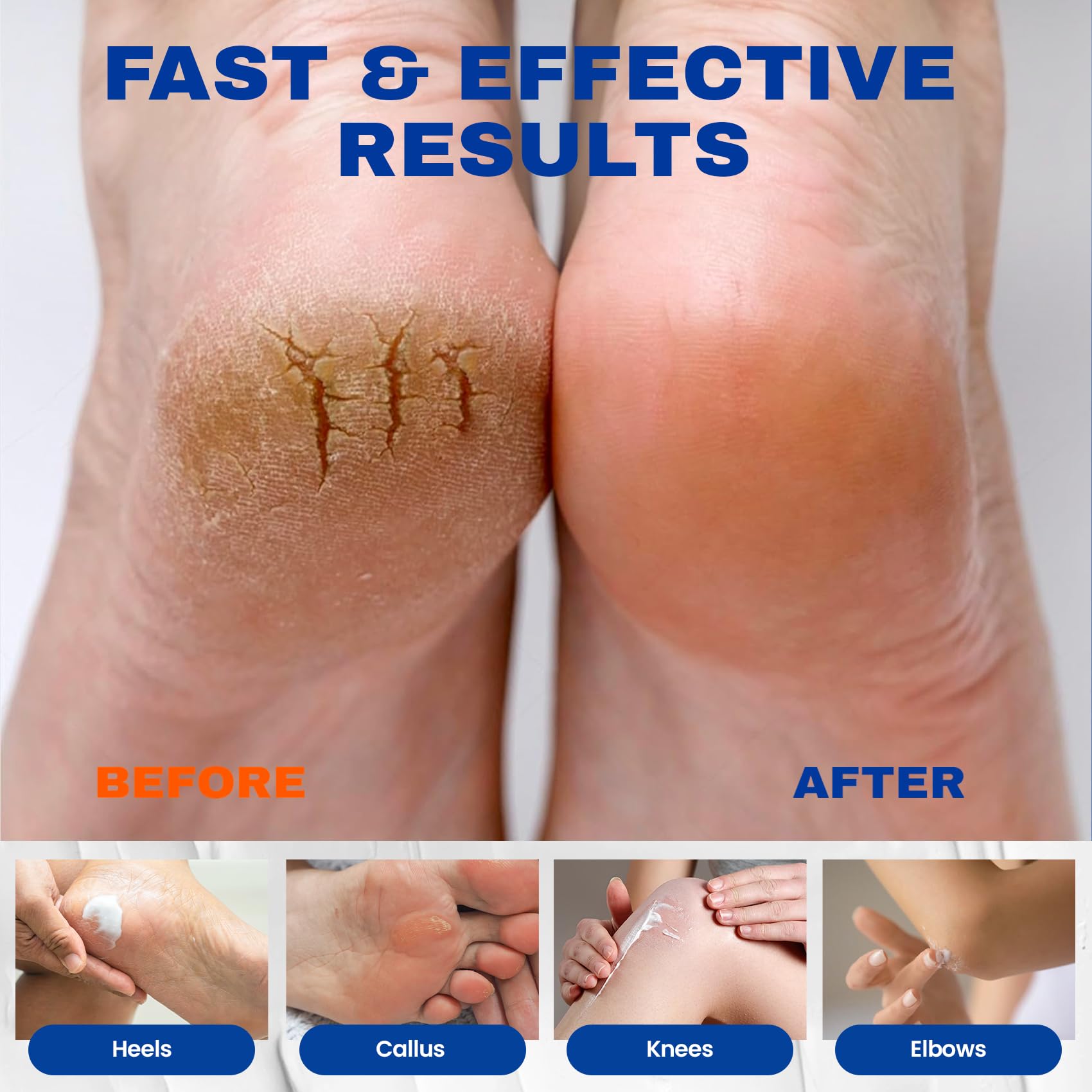 Skin Ultima intensive repair cream showing thick calloused heel application directions