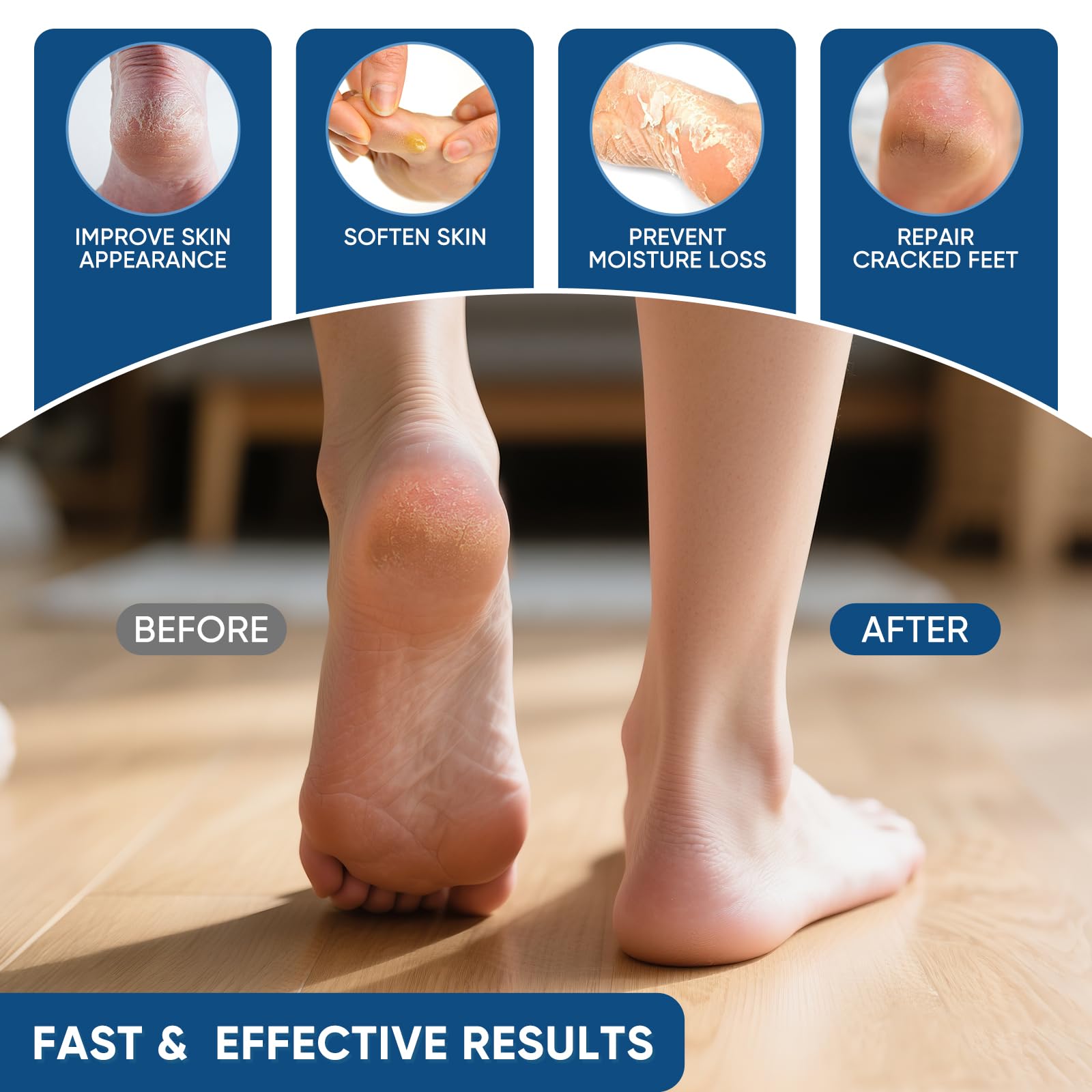 Authentic USA imported urea cream for rough skin and foot care