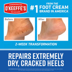 O'Keeffe's healthy feet kit application demonstration
