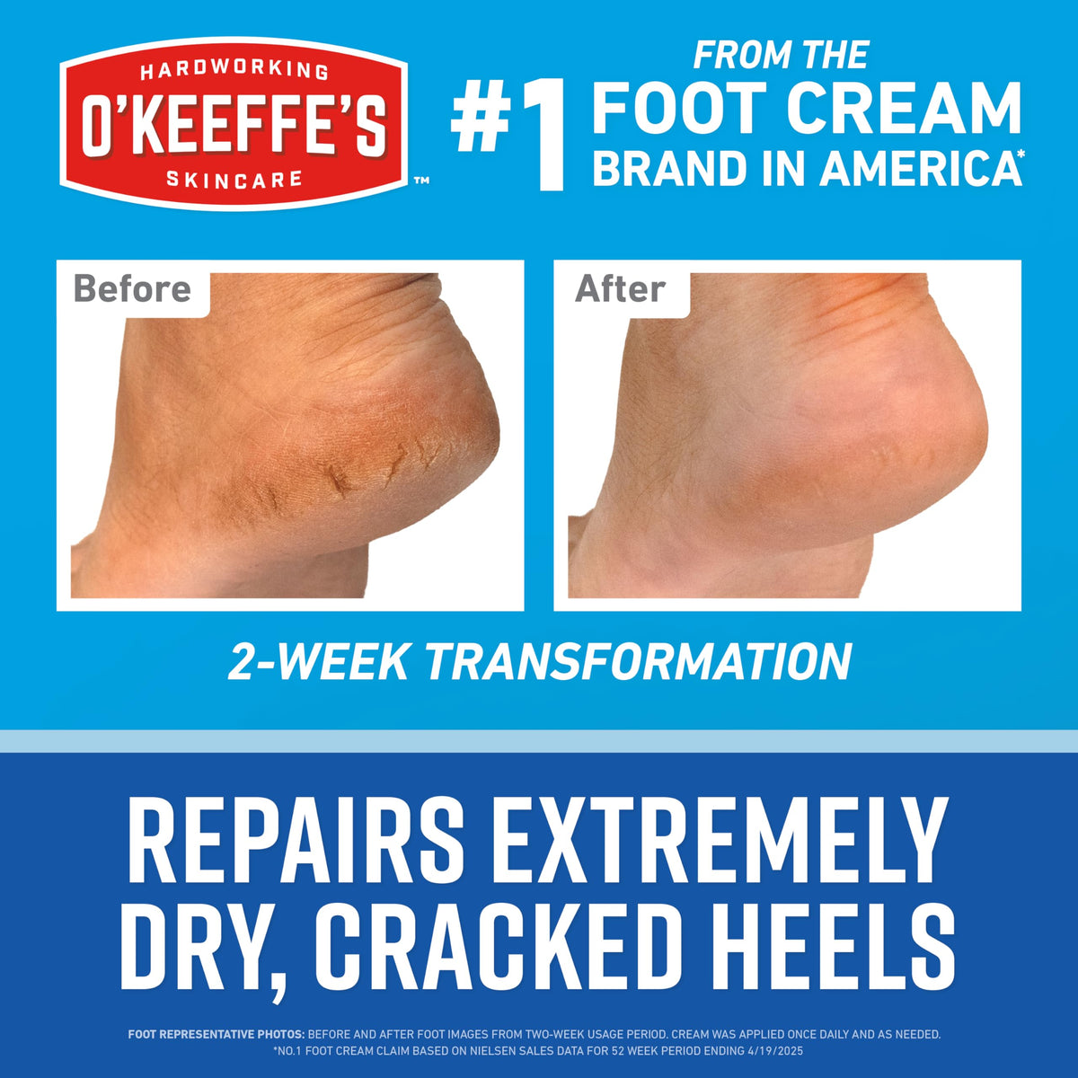 O'Keeffe's healthy feet kit application demonstration