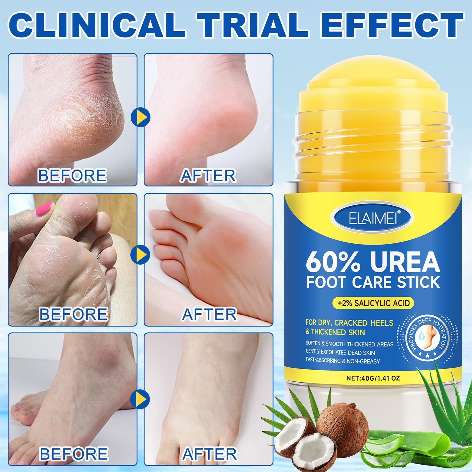 Close up of the product packaging highlighting the exfoliating and deeply hydrating benefits for feet knees and elbows.
