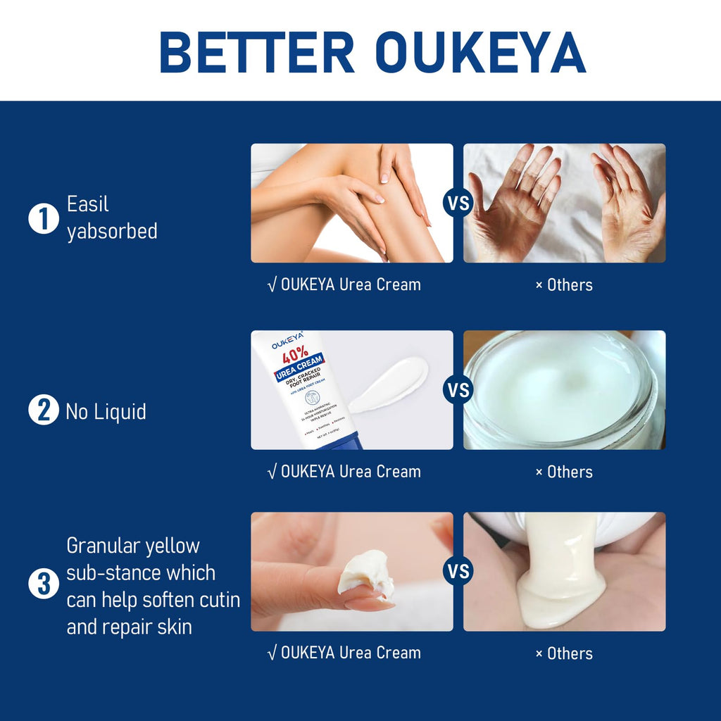 Oukeya urea cream texture demonstration