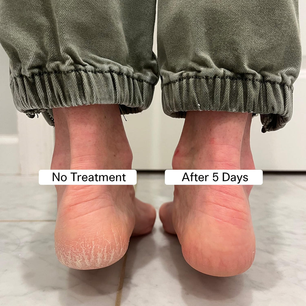 Pedestrian Project foot care balm stick ingredients label view