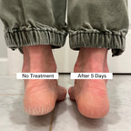 Pedestrian Project foot care balm stick ingredients label view