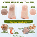 Close up view of soothing skin balm applied on dry feet