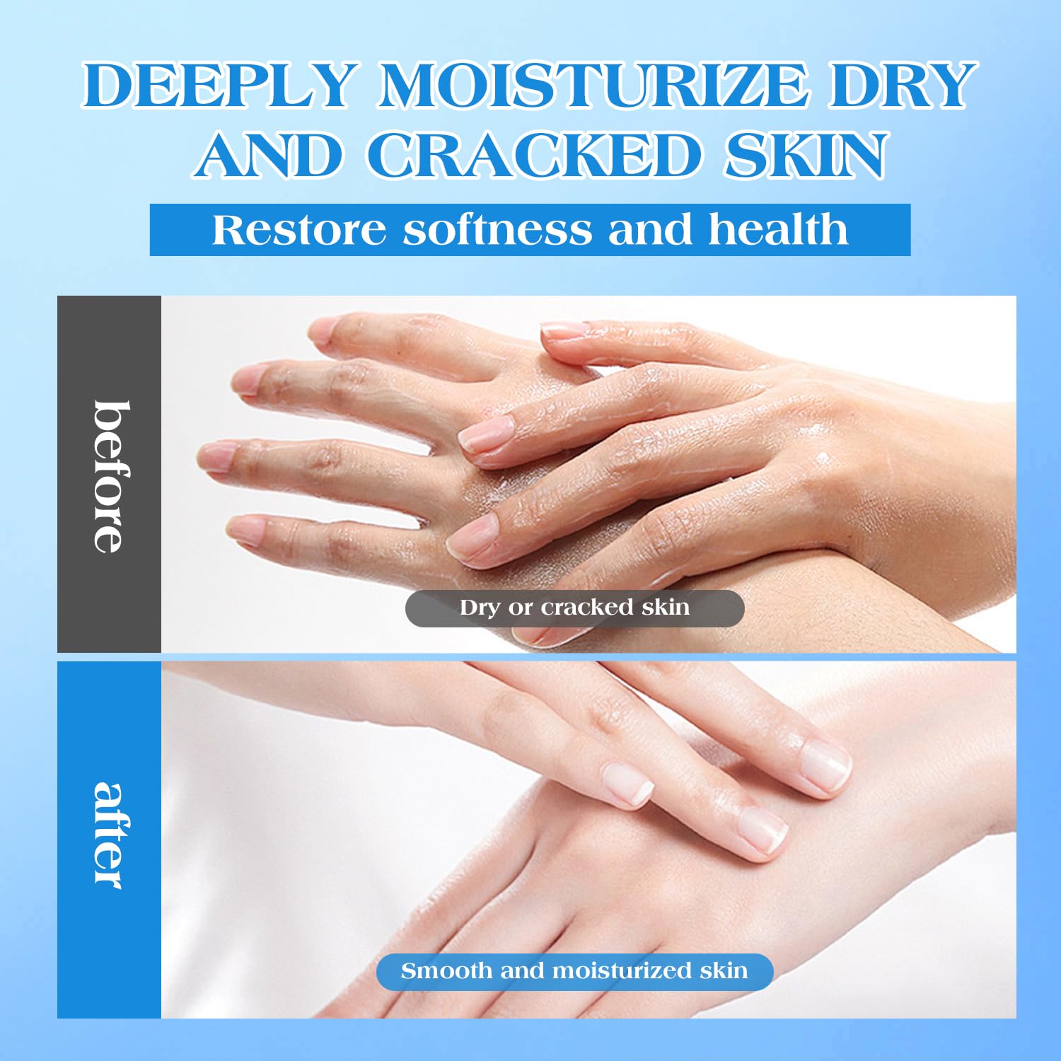 Texture preview showing the thick white consistency of URQT maximum strength forty two percent urea treatment lotion.