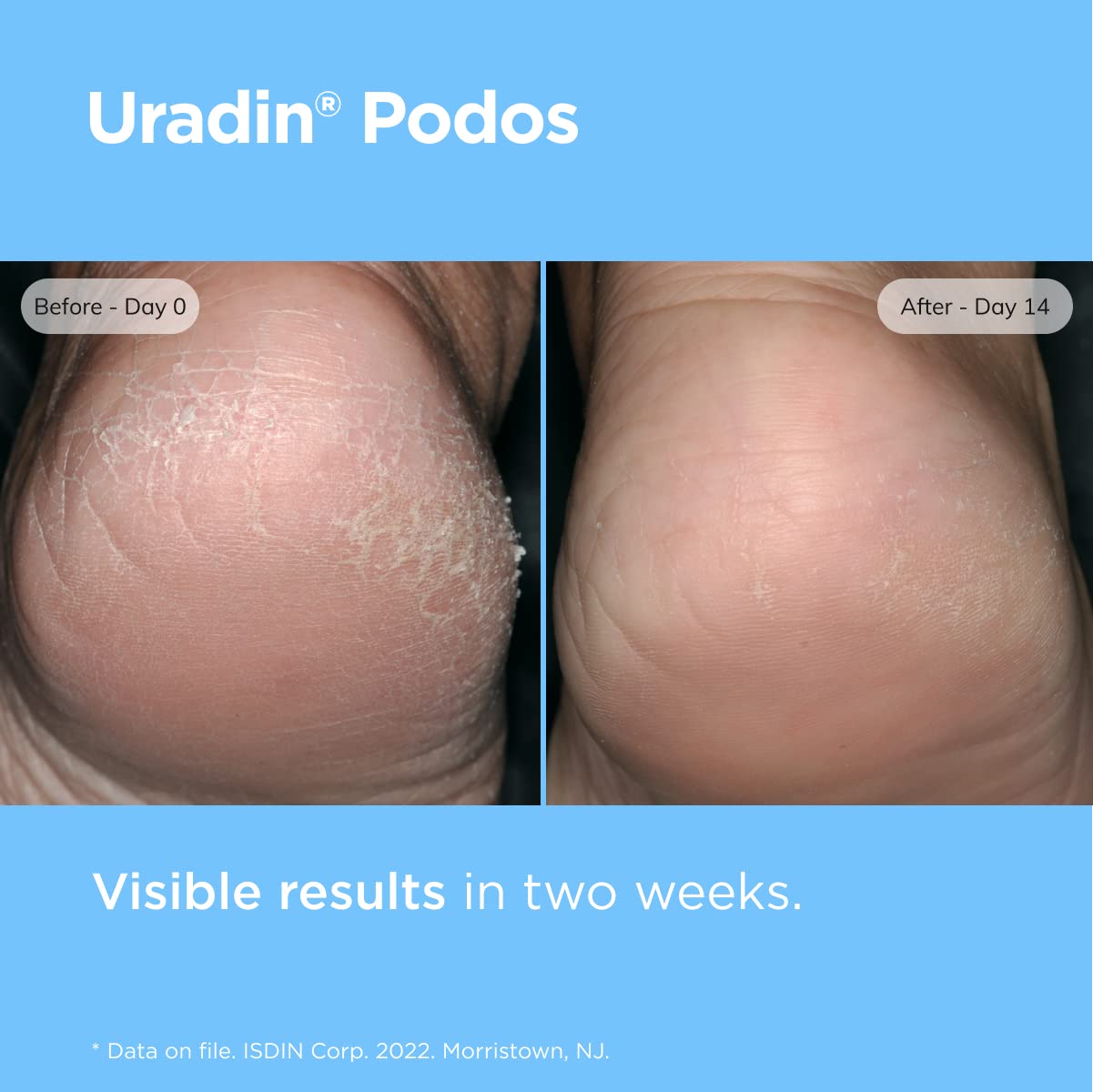 ISDIN foot care cream tube placed next to its authentic original product box