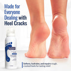 Footlogix cracked heel formula pump dispenser nozzle close up
