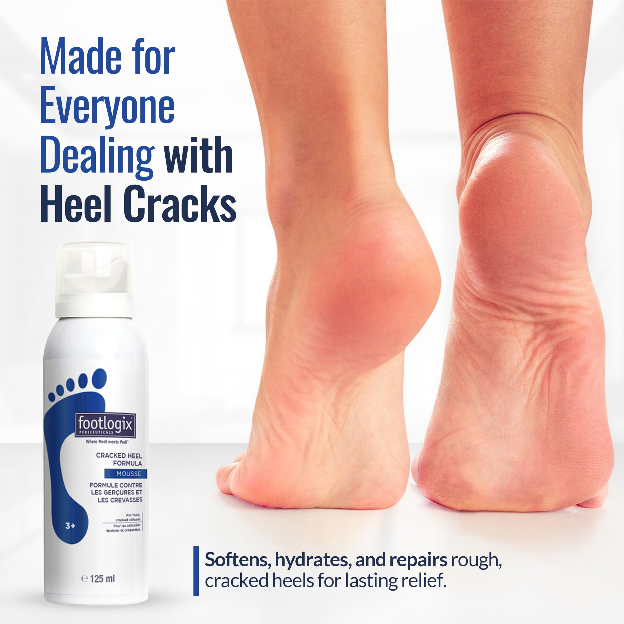 Close up of Footlogix mousse texture for non-greasy foot application