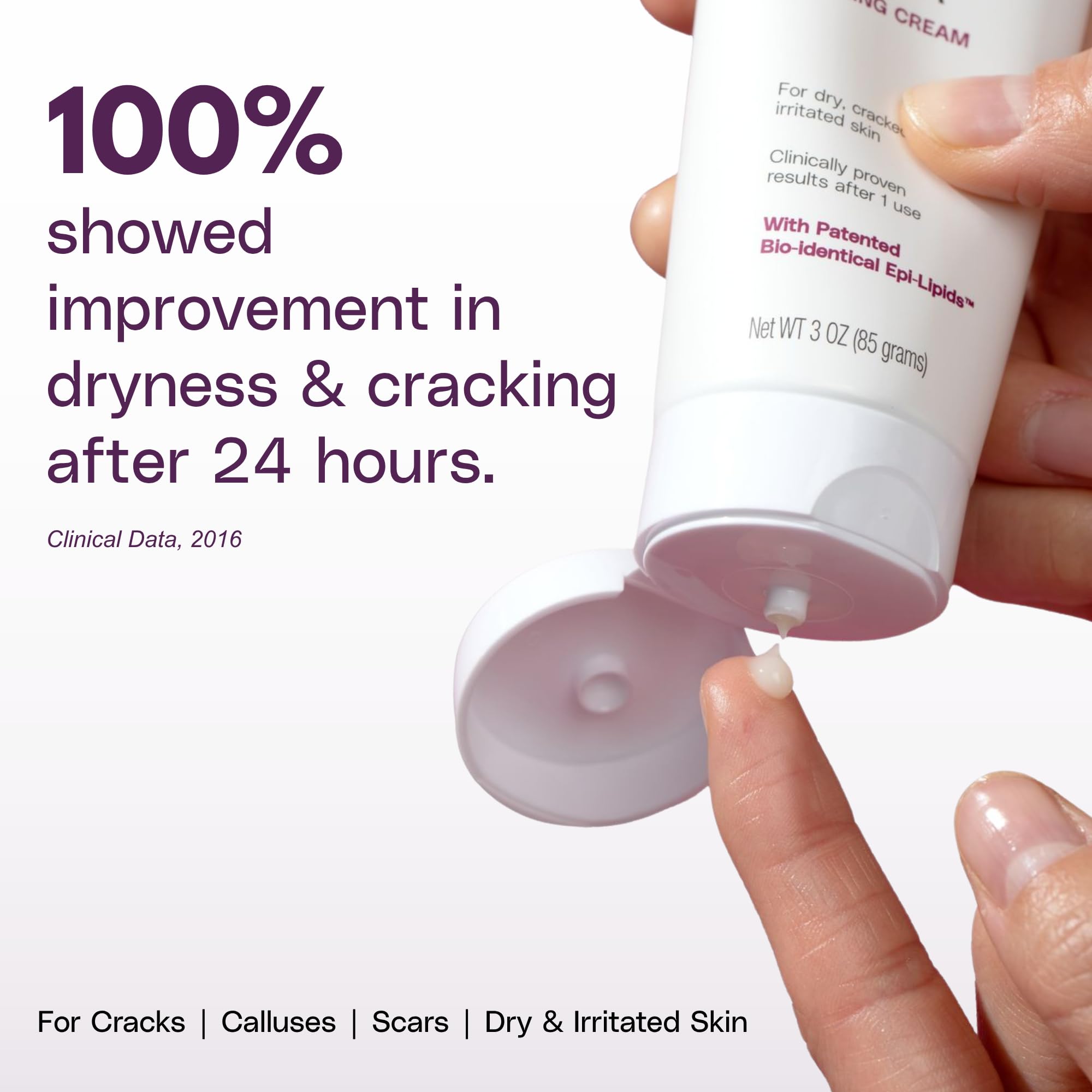 SkinIntegra therapeutic twenty five percent urea cream packaging displaying product features