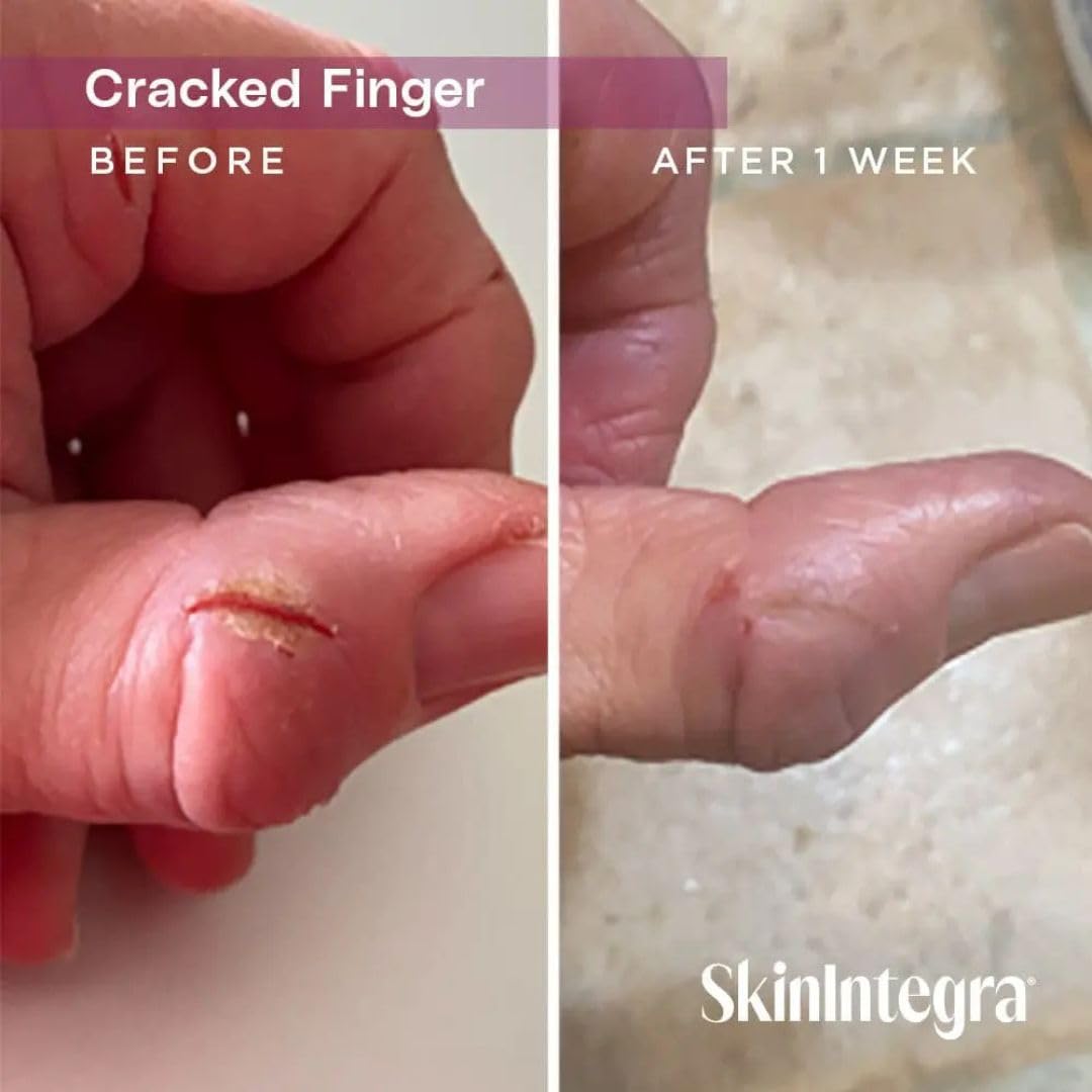 SkinIntegra fragrance free foot barrier cream for diabetic skin care management