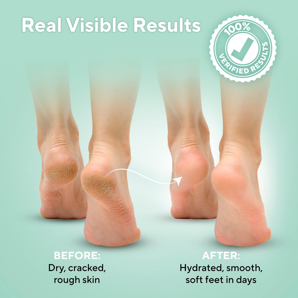 Close up of Lavinso foot cream texture for dry cracked heels