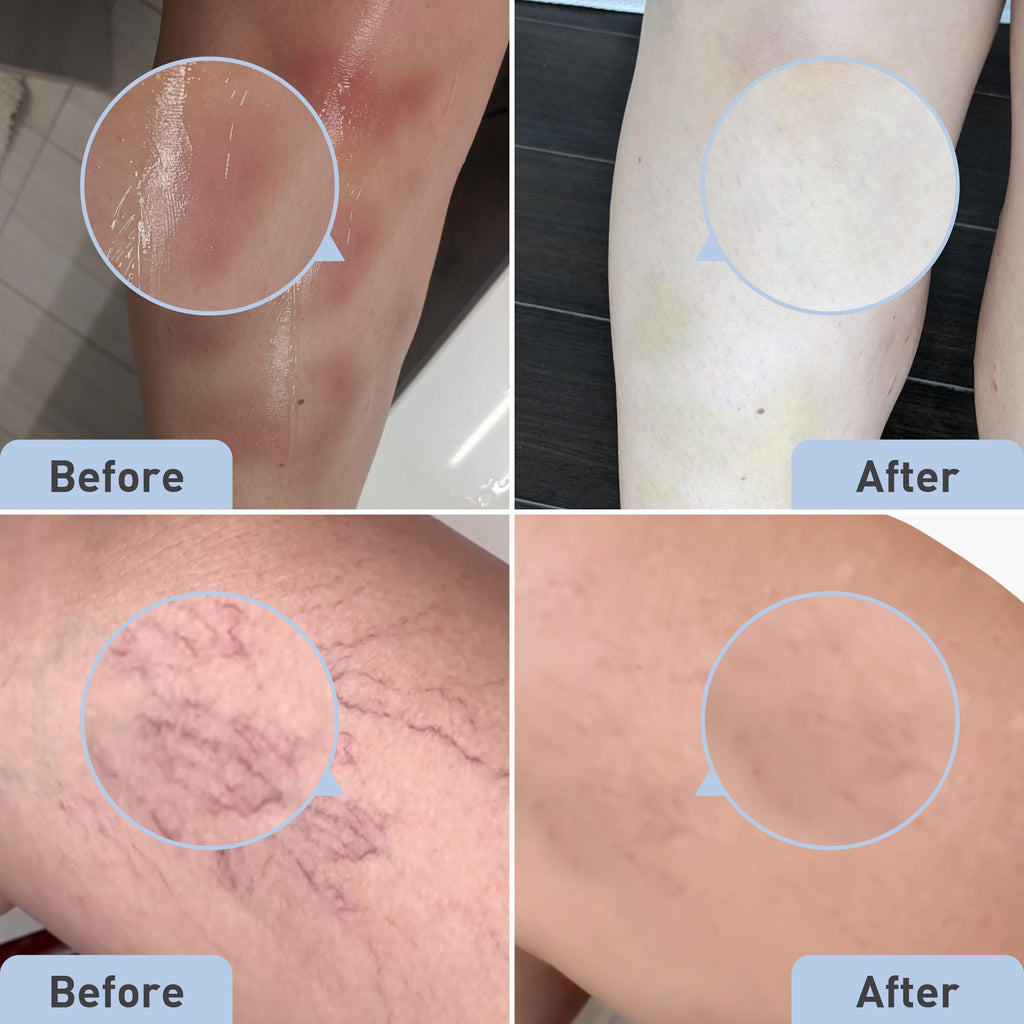 Pro Cure bruise remedy 2 ounce size comparison