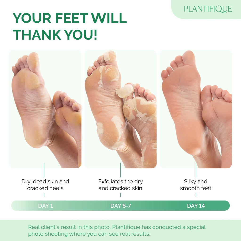 Plantifique foot peel mask box showing 2 pairs and peach variant