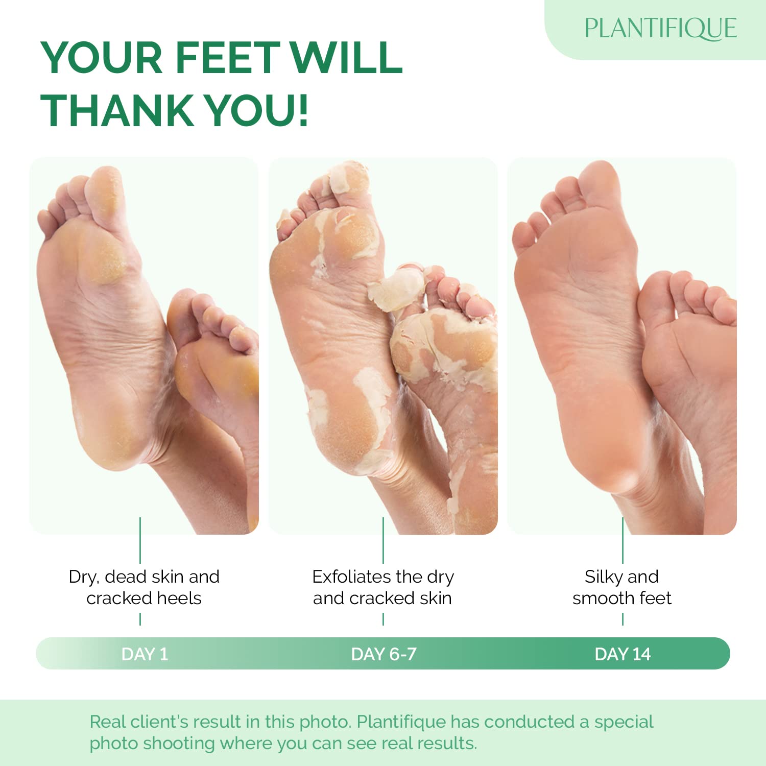 Close up of the exfoliating booties included in the two pair pack.