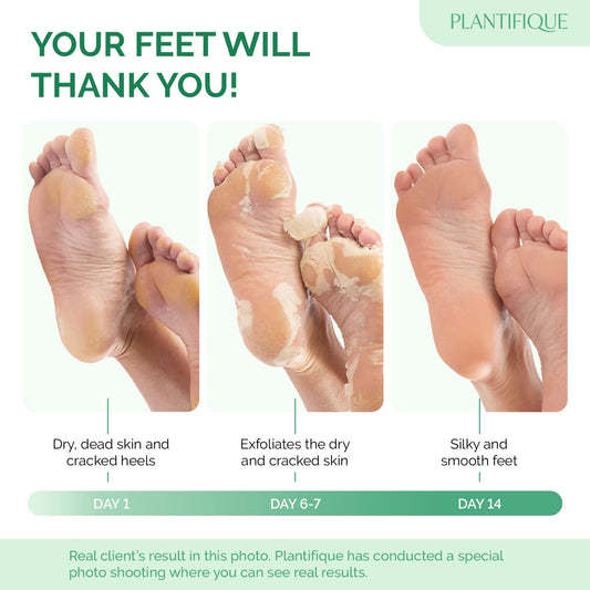 Close up of the exfoliating booties included in the two pair pack.