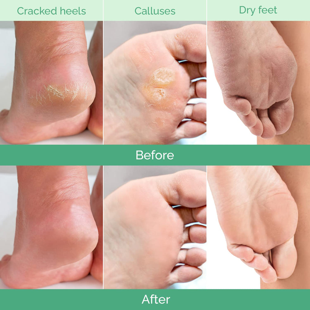 Close up of Plantifique foot peeling mask botanical ingredients label