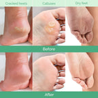Close up of Plantifique foot peeling mask botanical ingredients label