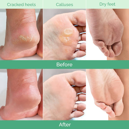 Plantifique foot mask ingredients list showing peach and botanical extracts.