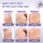 Funnir foot peel five pack box angle shot