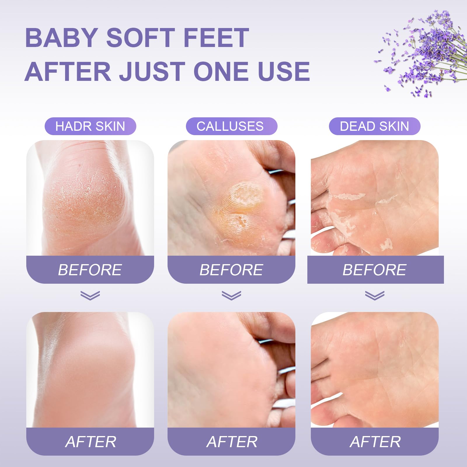 FUNNIR callus remover foot care treatment results close up
