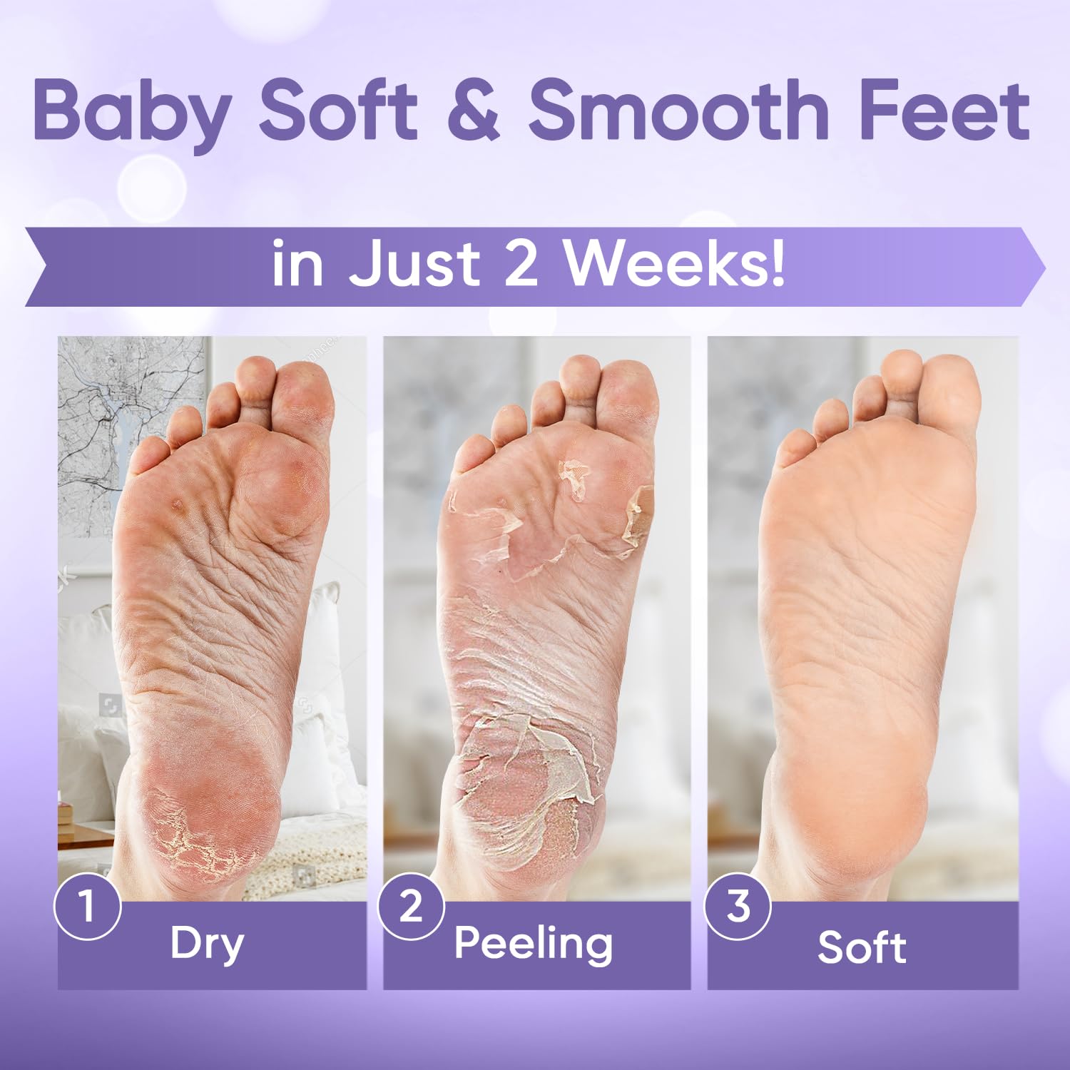 Before and after comparison of dry cracked heels versus baby soft feet.
