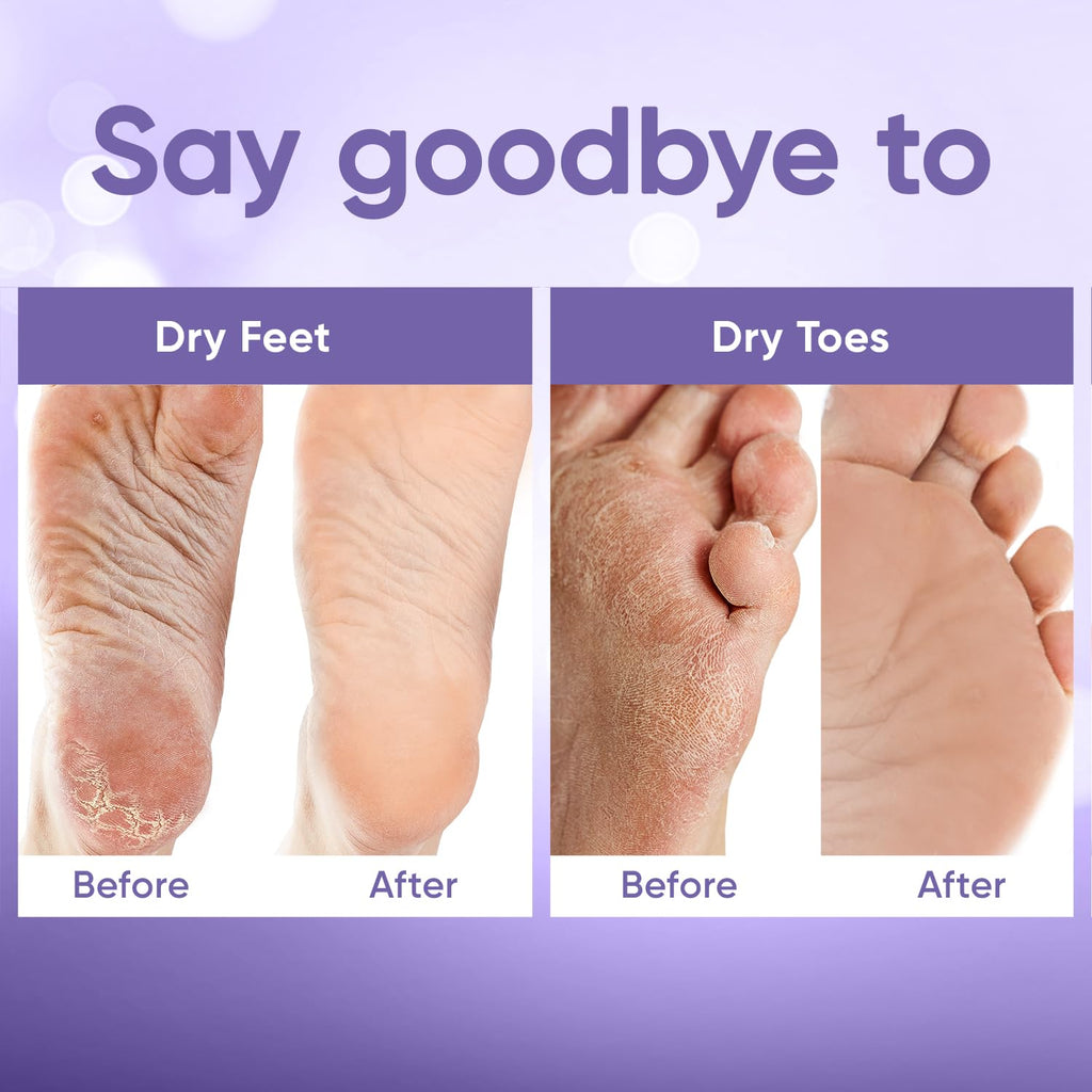 Célor callus removal foot treatment close up