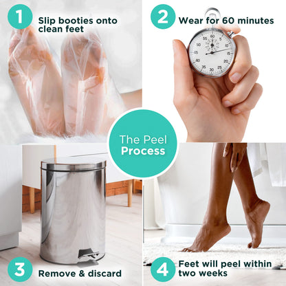 Dermora exfoliating socks being worn for dead skin removal.
