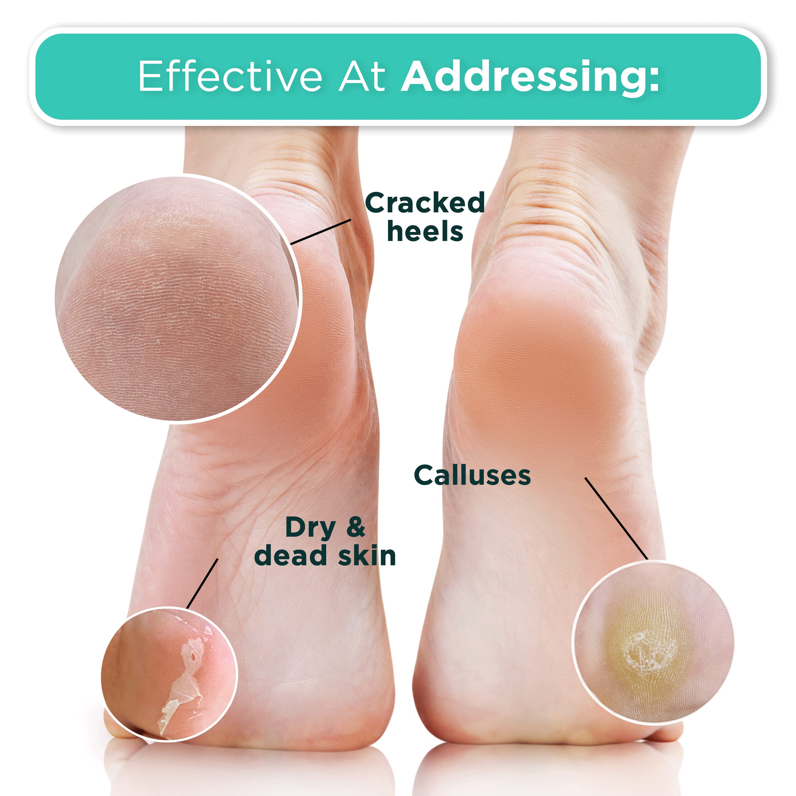 Instructions on the back of Dermora foot mask for cracked heels.