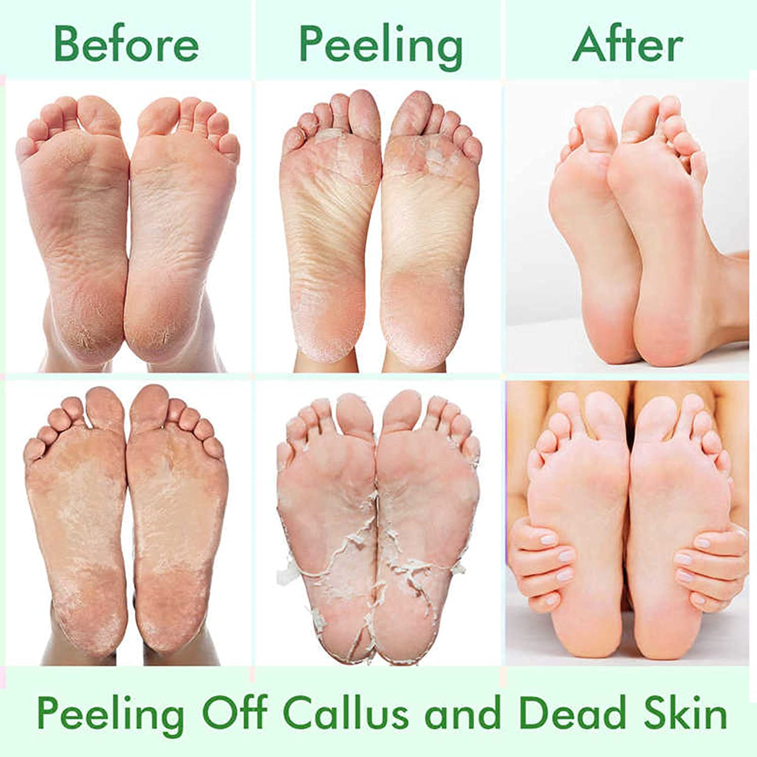 Step by step usage instructions for exfoliating foot peel