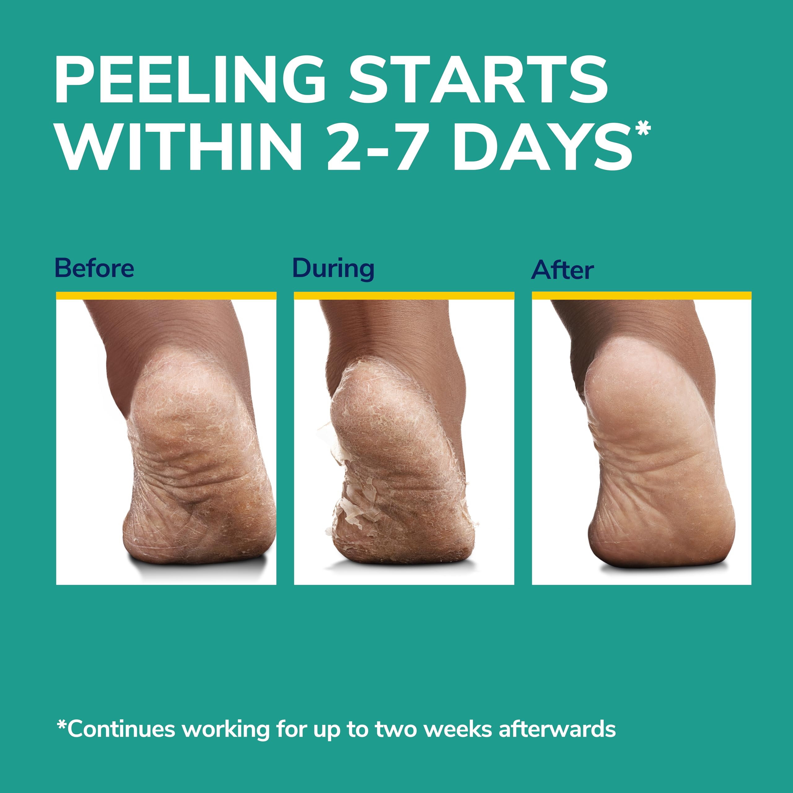 Dr. Scholl's exfoliating foot treatment showing the secure ankle tab feature.