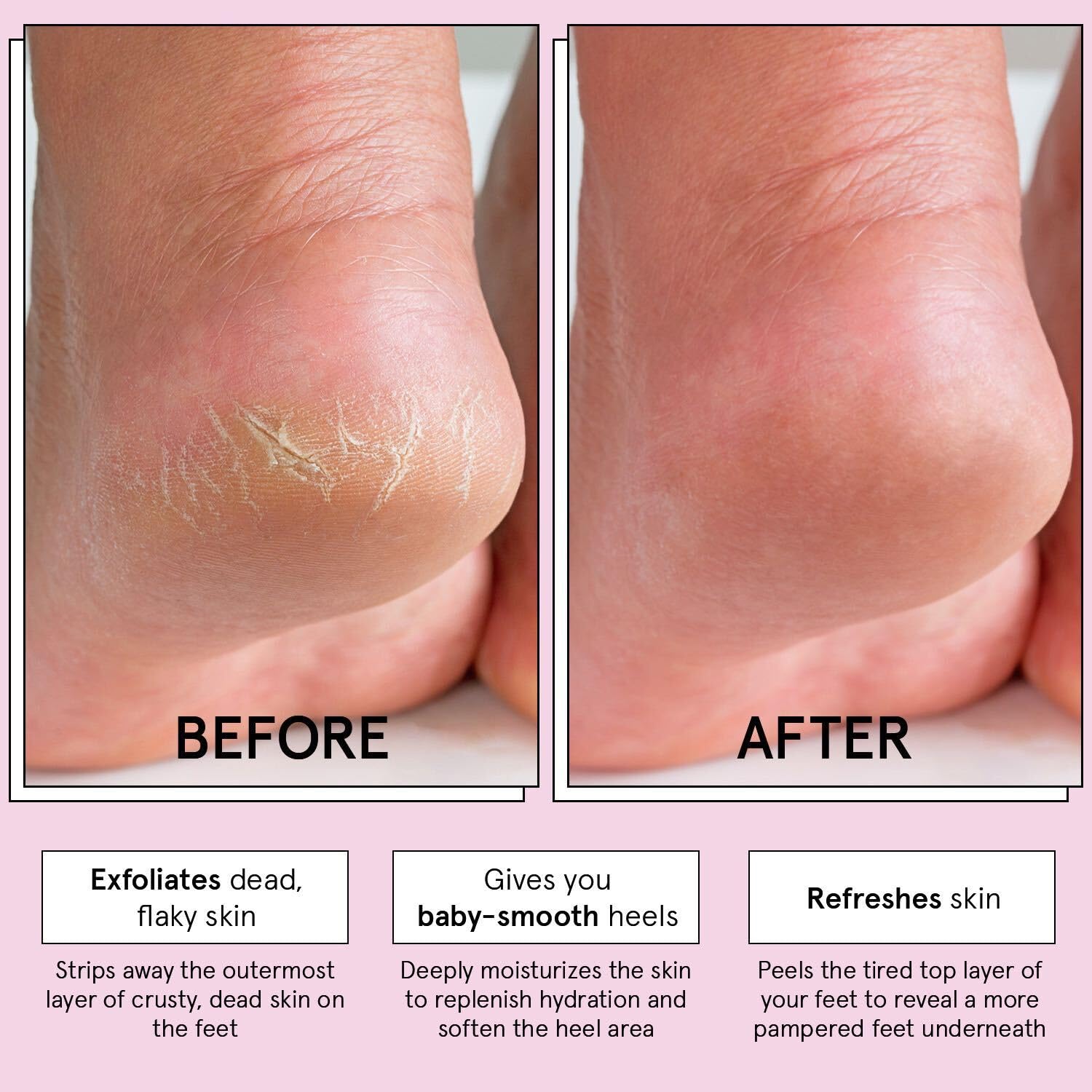 Foot peeling mask with aloe vera ingredients for cracked heels