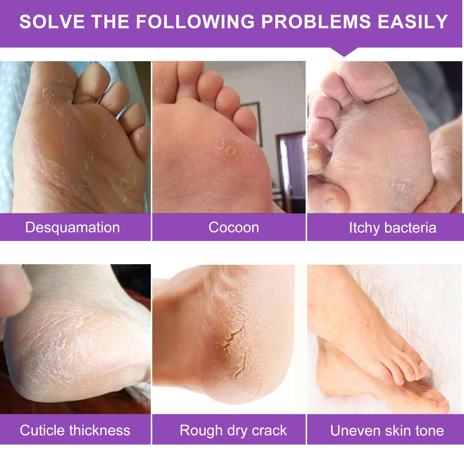 USA imported foot peel treatment package highlighting baby soft skin benefits