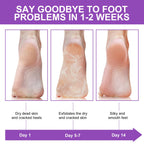 Sameriver foot peeling mask wearable sock fit demonstration