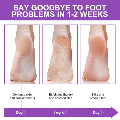 Premium foot peeling treatment value pack for cracked heels and dry skin