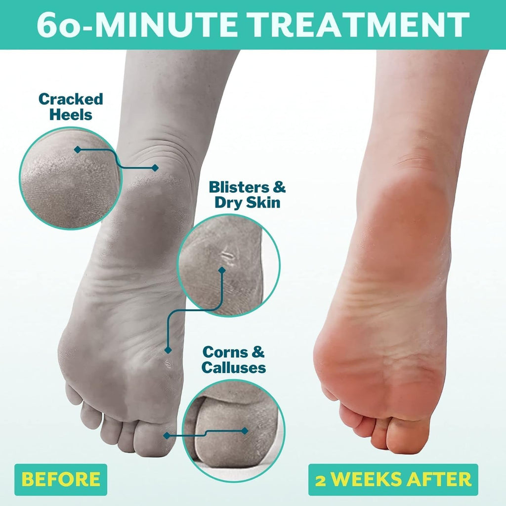 Patchology foot peel booties and activating essence pouch
