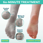 Patchology foot peel booties and activating essence pouch