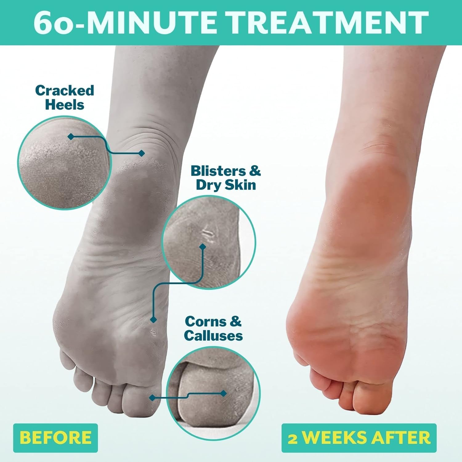 Patchology foot mask socks being applied for an at-home pedicure.