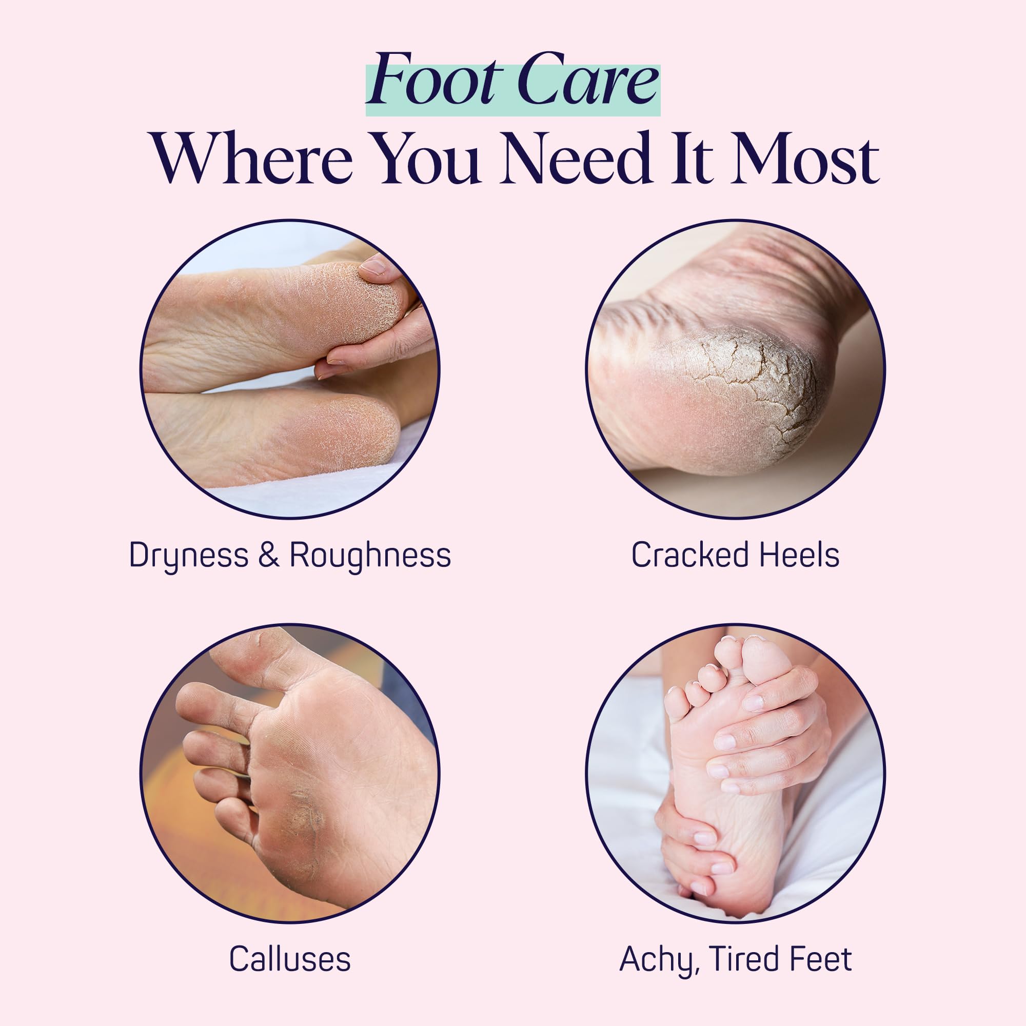 SpaLife invigorating spearmint and tea tree oil foot treatment for cracked heels