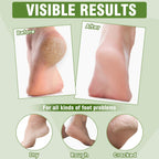 TEAWOO eighteen pairs foot mask box open display