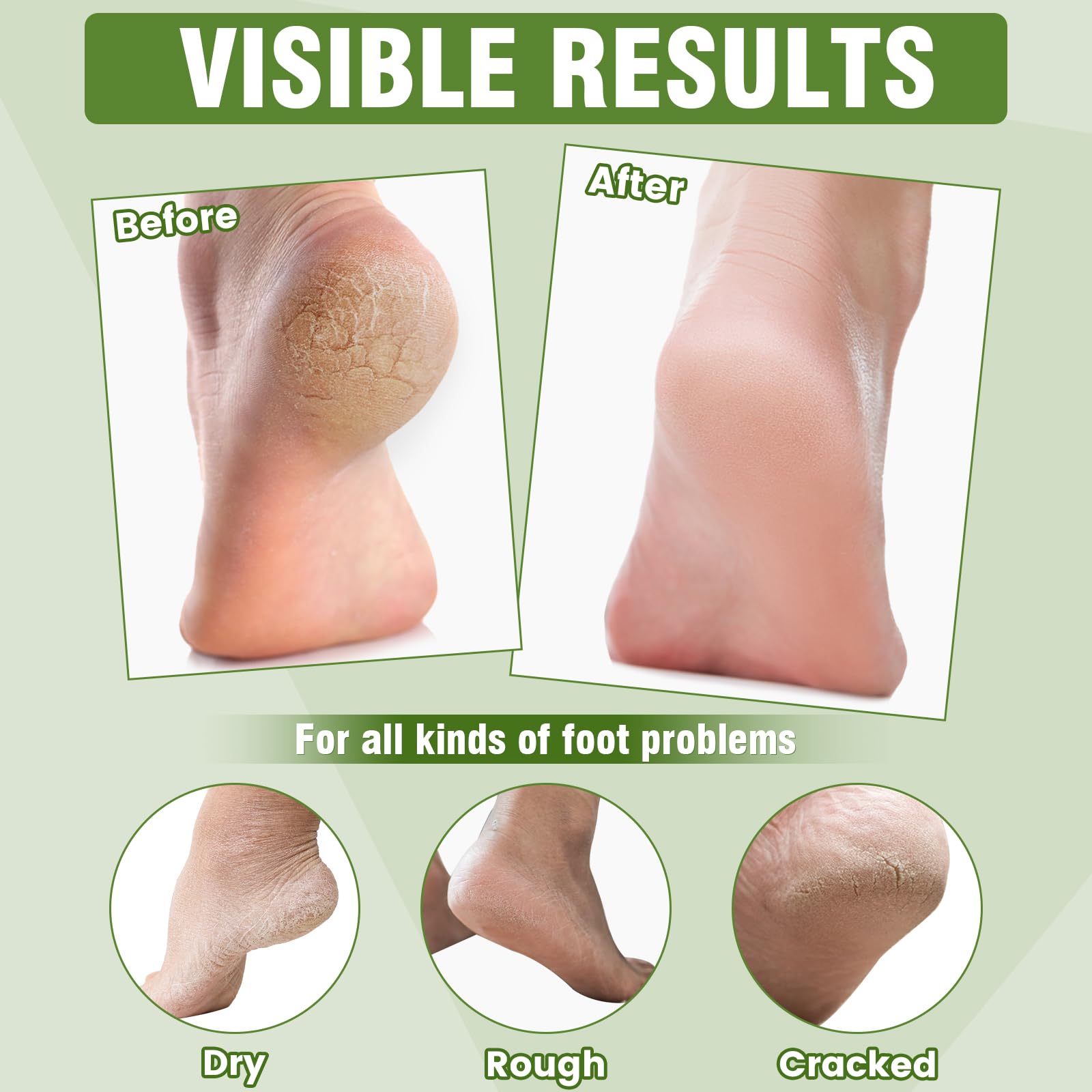 Dermatologist tested foot care socks infused with shea butter and jojoba oil