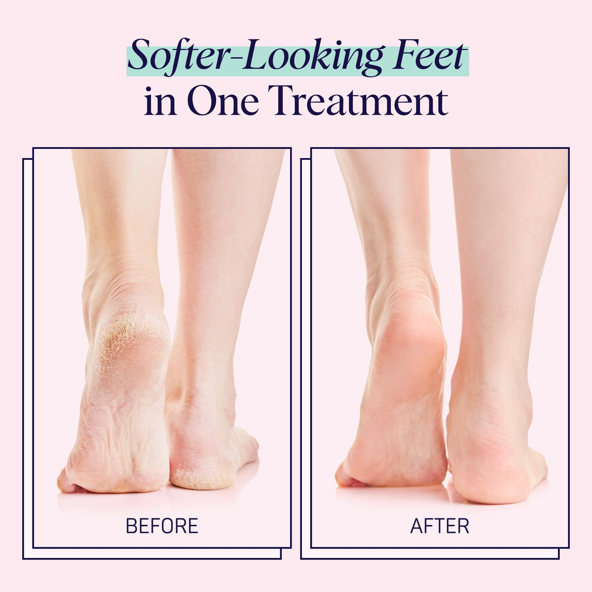 Spalife moisturizing foot mask individual pouch layout