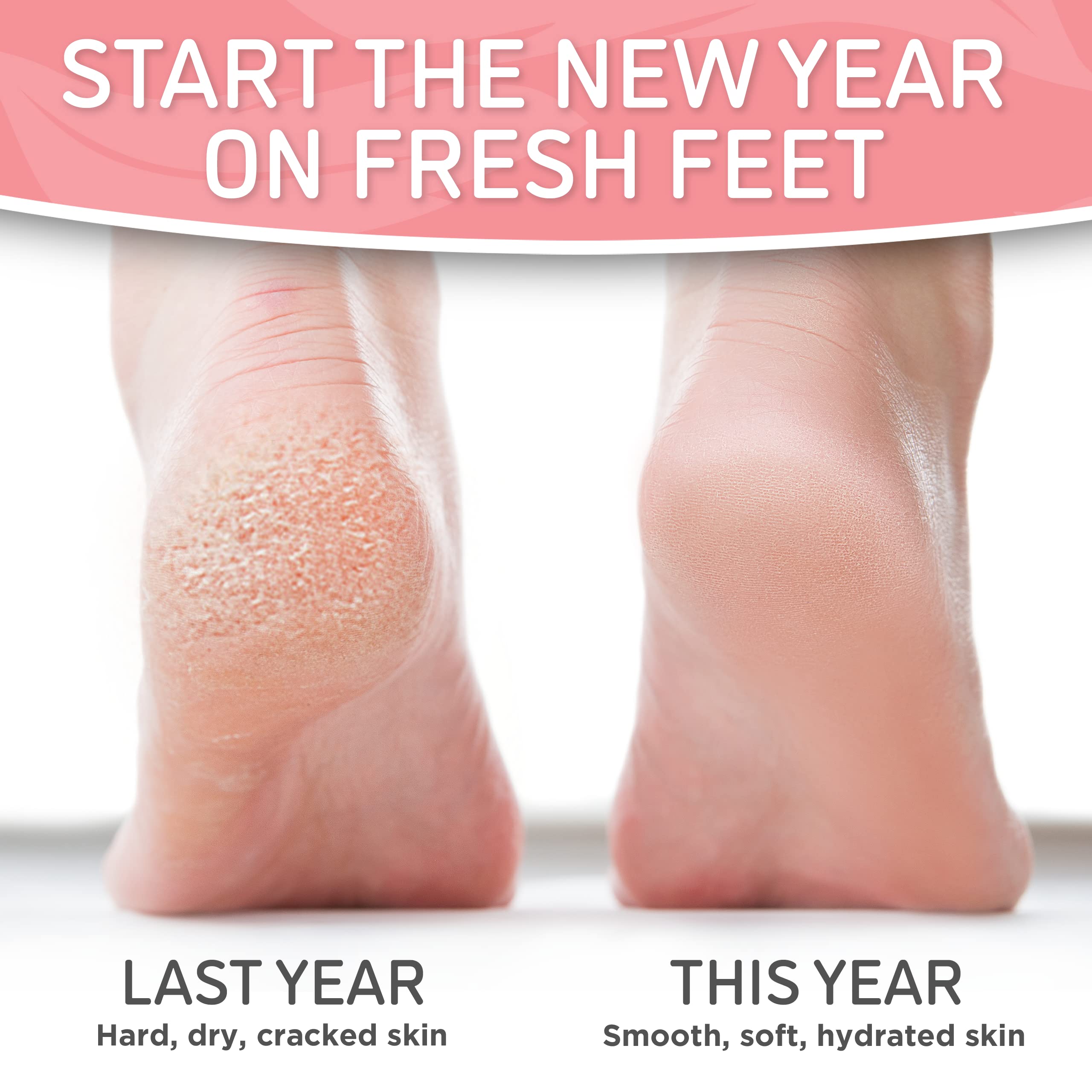 Before and after visualization of foot peeling process for baby soft skin.