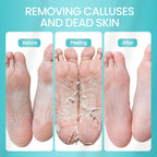 Side angle view of Sunatoria foot care packaging