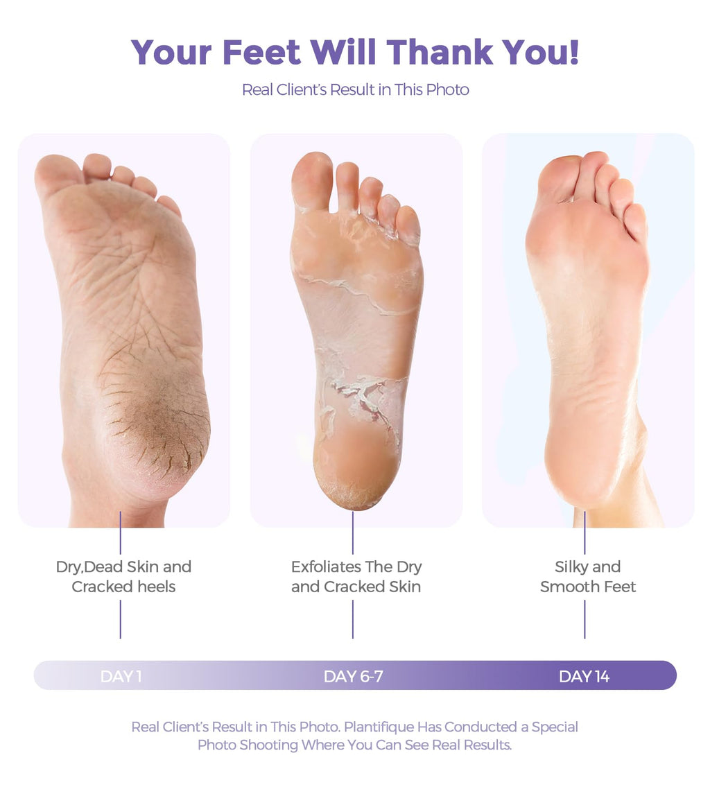 Rokelos callus repair foot peel treatment contents