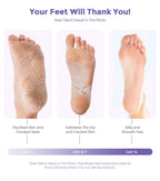 Rokelos callus repair foot peel treatment contents