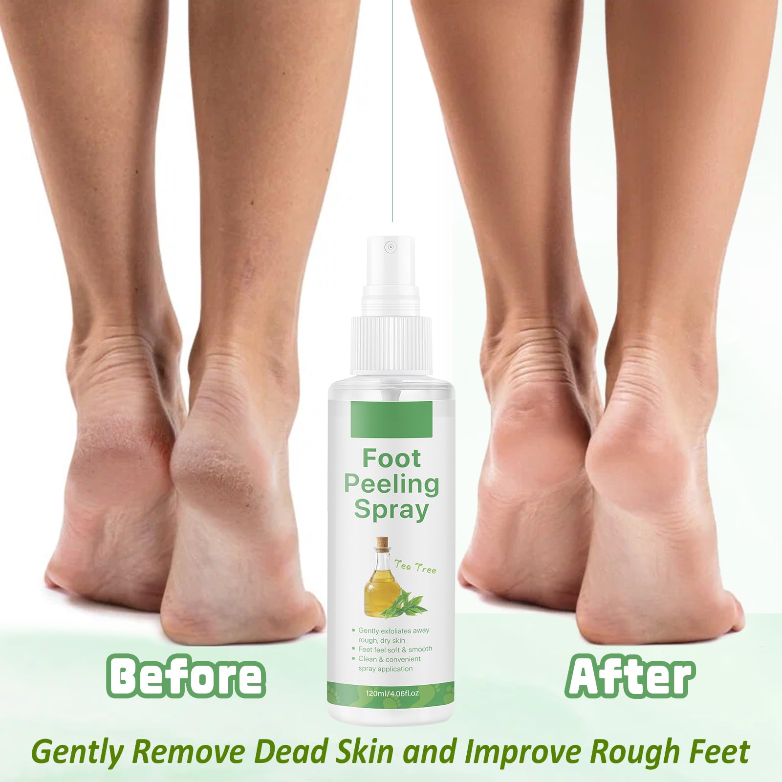 Before and after results of using tea tree peeling spray on rough foot calluses.
